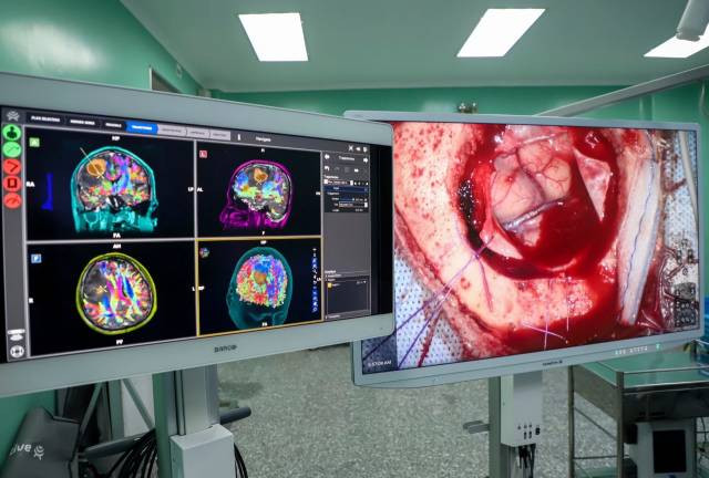 Les images 3D des faisceaux nerveux sont fournies par un robot IA, permettant ainsi aux médecins de planifier la trajectoire chirurgicale sans toucher les nerfs. Photo : lifestyle.znews.vn Les images 3D des faisceaux nerveux sont fournies par un robot IA, permettant ainsi aux médecins de planifier la trajectoire chirurgicale sans toucher les nerfs. Photo : lifestyle.znews.vn