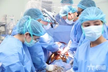Des médecins de l'hôpital central militaire 108 réalisent une transplantation cardiaque. Photo : qdnd.vn