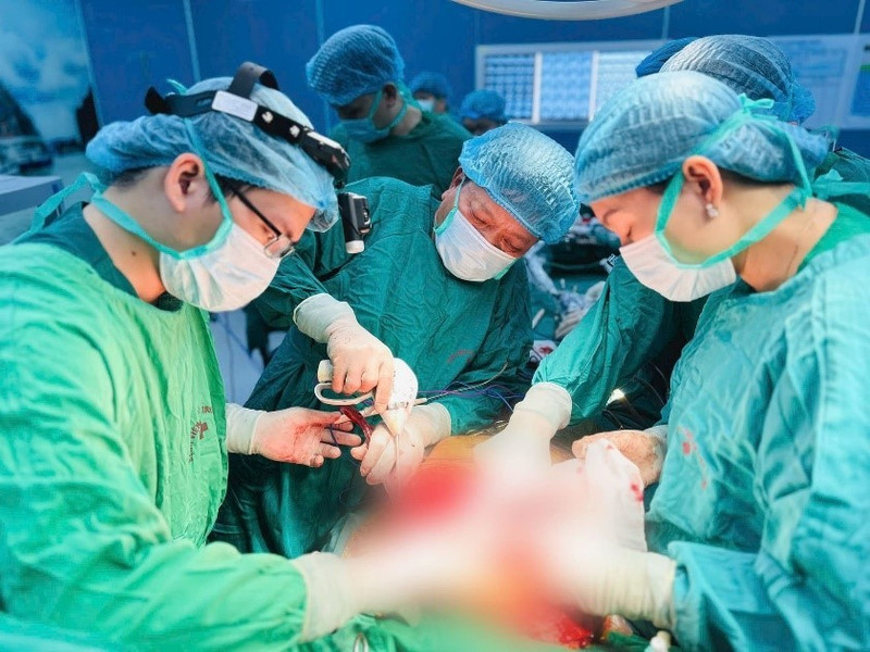 Des médecins de l'Hôpital Cho Ray effectuent une opération. Photo : MOH.