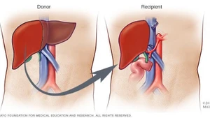 La transplantation d'organes au Vietnam à l'ère de la médecine de pointe