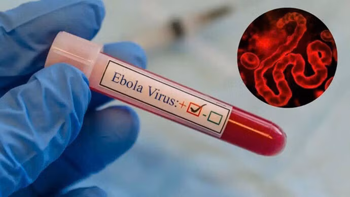 La maladie à virus Ebola se transmet principalement par contact direct avec le sang, les tissus ou les liquides corporels d’animaux ou de personnes infectés. Photo : CVN.