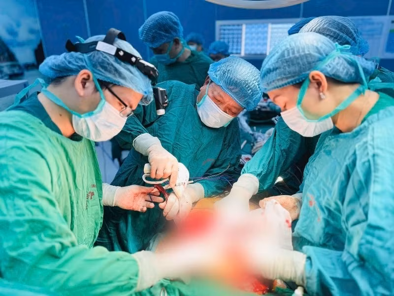Des médecins de l'Hôpital Cho Ray effectuent une opération. Photo : MOH.