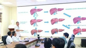 [Infographie] Exploit de la première greffe d’organes domino au Vietnam