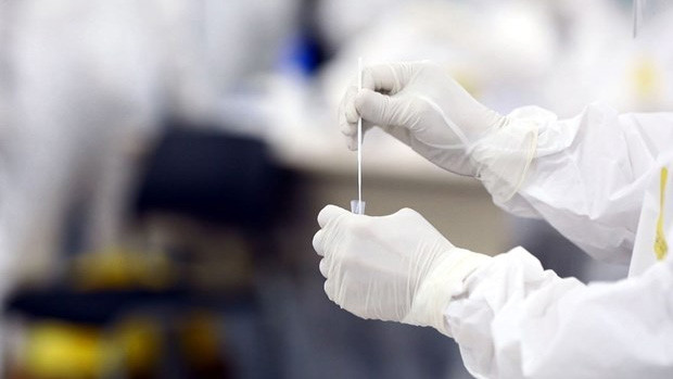 Des tests pour le dépistage du coronavirus. Photo : VNA.