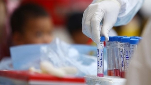 Echantillons pour des tests de dépistage du coronavirus SARS-CoV-2. Photo : VNA.