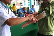 L’ajustement de prothèses et d’orthèses est une étape dans le processus de fourniture d’appareils d’assistance aux personnes handicapées dans trois provinces bénéficiaires du projet Inclusion 1. Photo : thoidai.