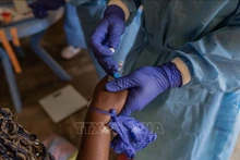 Le personnel médical prend en charge un patient atteint de la variole du singe à l'hôpital de la province du Nord-Kivu, en RDC, le 19 août 2024. Photo : Xinhua/VNA. 