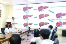 [Infographie] Exploit de la première greffe d’organes domino au Vietnam