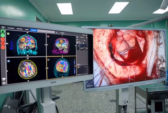 Les images 3D des faisceaux nerveux sont fournies par un robot IA, permettant ainsi aux médecins de planifier la trajectoire chirurgicale sans toucher les nerfs. Photo : lifestyle.znews.vn Les images 3D des faisceaux nerveux sont fournies par un robot IA, permettant ainsi aux médecins de planifier la trajectoire chirurgicale sans toucher les nerfs. Photo : lifestyle.znews.vn