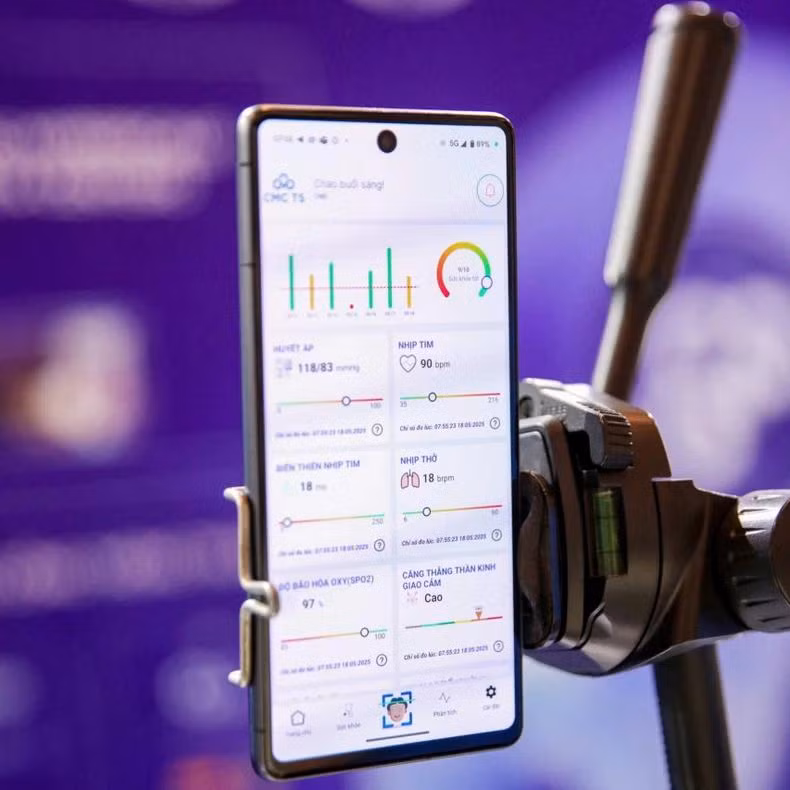 L'application C-Health intègre de nombreuses fonctionnalités capables de mesurer rapidement plus de 20 indicateurs sanitaires de base, aidant les utilisateurs à gérer leur santé personnelle de manière globale. Photo : NDEL.